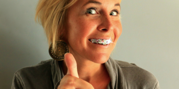 Braces BLING Only $20 Per Month