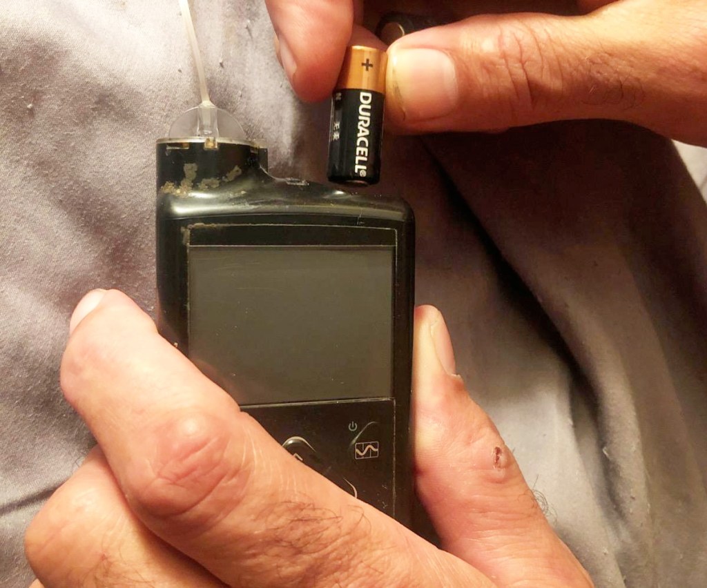 person inserting duracell battery into medical device