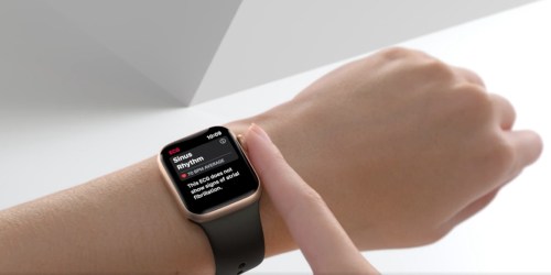 Apple Watch Series 6 w/ GPS + Cellular Only $399.98 Shipped on Amazon (Regularly $499)