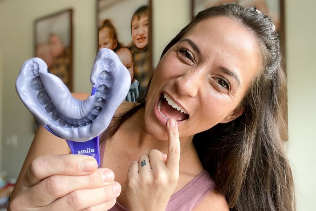 woman holding an impression kit from Smile Direct Club.