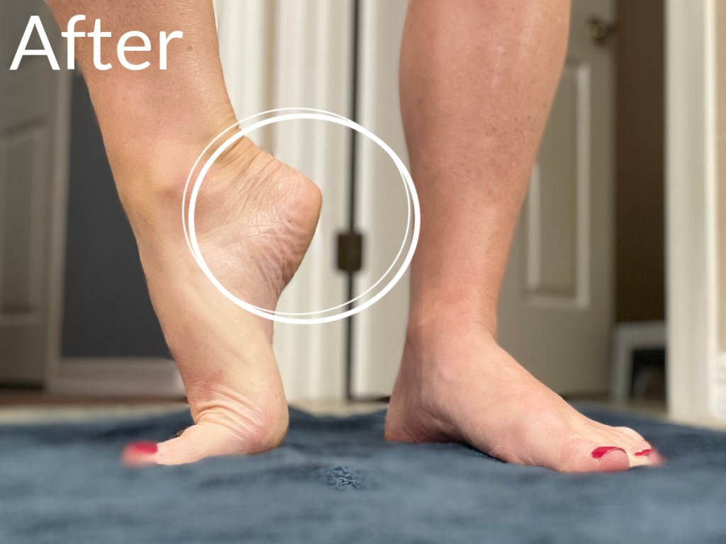 smooth foot heel after using baby peel