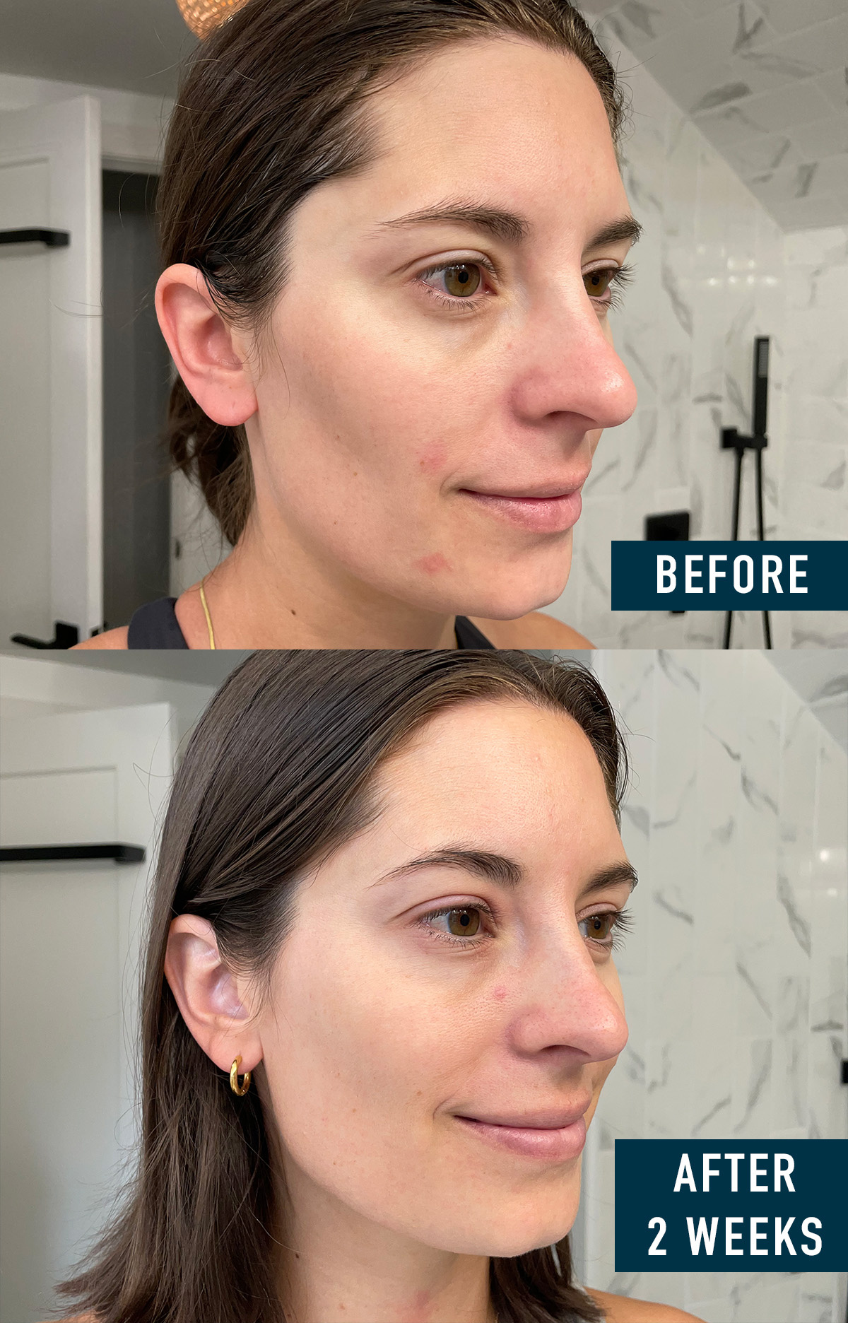 Olay Super Serum results showing why it is one of the top best beauty products of 2023.
