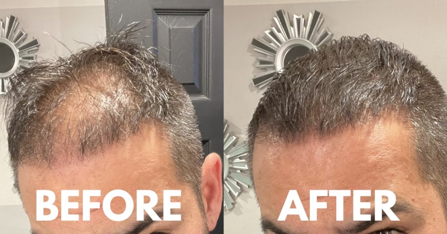 man's scalp showing grey roots before using hairline powder and after using