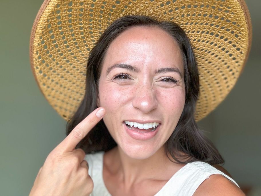 A woman with a hat on pointing to the freckles on her face