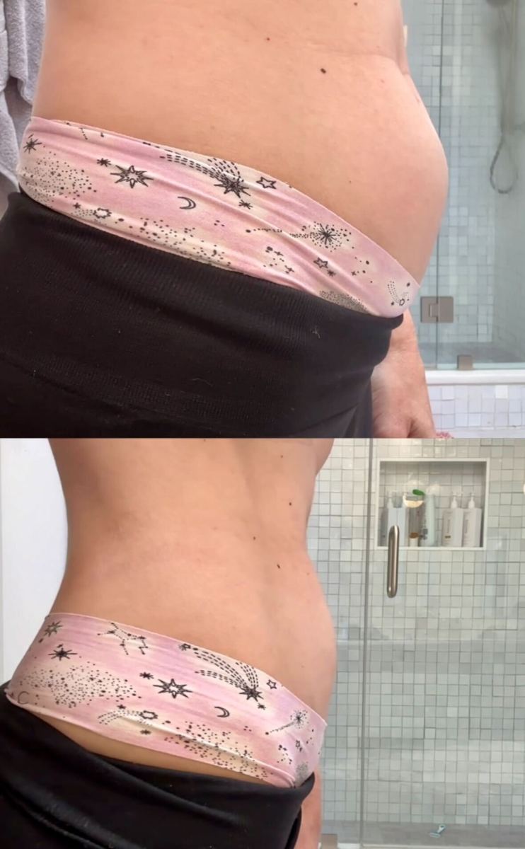 comparison of a womans stomach before and after taking jshealth bloat vitamins