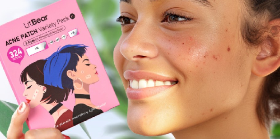 Pimple Patches 324-Pack Just $4 Shipped for Prime Members (Reg. $10)