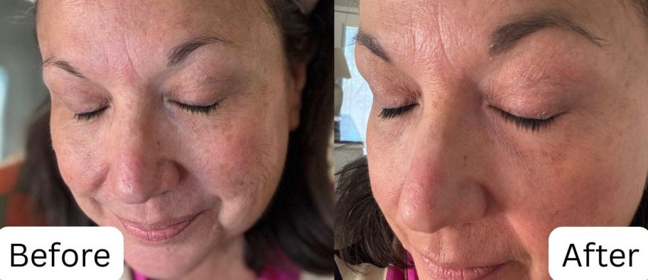 Woman before and after using eyelash serum