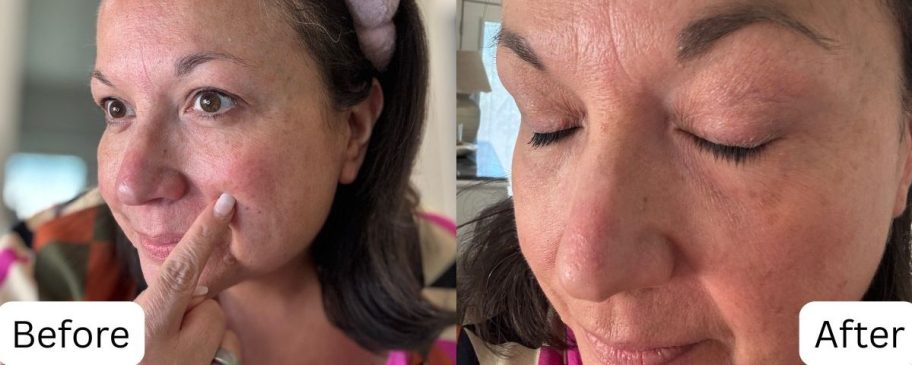 Woman before and after spot corrector